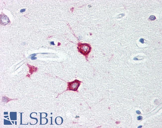 Anti-TOLLIP antibody IHC of human brain, cortex. Immunohistochemistry of formalin-fixed, paraffin-embedded tissue after heat-induced antigen retrieval. Antibody LS-B608 concentration 3 ug/ml.