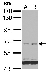 Sample (30 ug of whole cell lysate) A: NT2D1 B: PC-3 7.5% SDS PAGE FAM111B antibody diluted at 1:1000