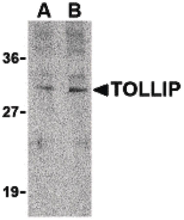 Western blot of TOLLIP in rat brain cell lysate with TOLLIP antibody at (A) 1 and (B) 2 ug/ml.