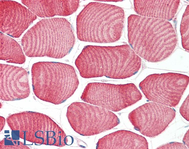 Anti-FBXO32 / MAFBX / Atrogin 1 antibody IHC staining of human skeletal muscle. Immunohistochemistry of formalin-fixed, paraffin-embedded tissue after heat-induced antigen retrieval. Antibody LS-B9748 concentration 5 ug/ml.