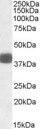 FBXO32 antibody (0.1 ug/ml) staining of Human Skeletal Muscle lysate (35 ug protein/ml in RIPA buffer). Primary incubation was 1 hour. Detected by chemiluminescence.