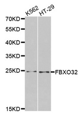 Western blot analysis of extracts of various cell lines, using FBXO32 antibody.