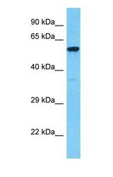 Western blot of TOM1 Antibody with 786-0 Whole Cell lysate.