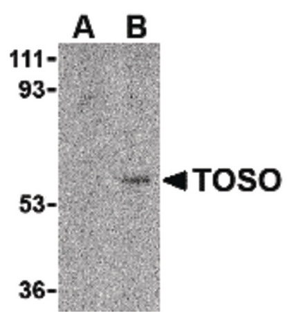 Western blot of Toso in human lung tissue lysate with Toso antibody at 1 ug/ml in either the (A) presence, or (B) absence of blocking peptide.