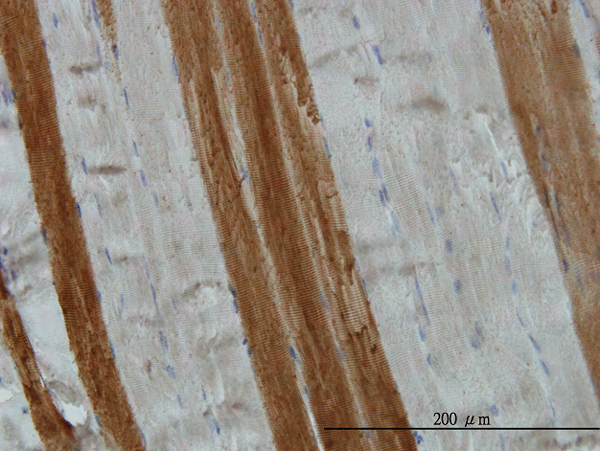 Immunoperoxidase of monoclonal antibody to TOM1 on formalin-fixed paraffin-embedded human skeletal muscle. [antibody concentration 3 ug/ml]