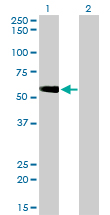 Western blot of TOM1 expression in transfected 293T cell line by TOM1 monoclonal antibody (M01), clone 5A3.