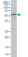 TOM1 monoclonal antibody (M01), clone 5A3 Western blot of TOM1 expression in K-562.