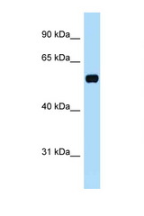 TOM1L1 antibody LS-C145996 Western blot of Fetal Brain lysate. Antibody concentration 1 ug/ml.