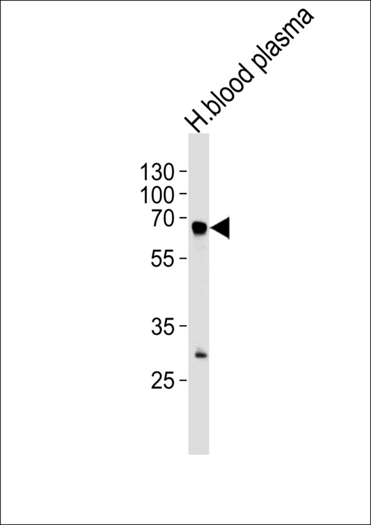FGA Antibody western blot of human blood plasma tissue lysates (35 ug/lane). The FGA antibody detected the FGA protein (arrow).