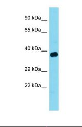 Western blot of Mouse Muscle . Tom1l1 antibody dilution 1.0 ug/ml.