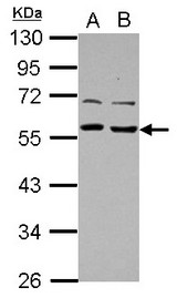 Sample (30 ug of whole cell lysate) A: A431 B: HeLa 10% SDS PAGE TOM1L1 antibody diluted at 1:1000