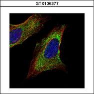 Confocal immunofluorescence analysis (Olympus FV10i) of methanol-fixed HeLa using TOM1L1 antibody (Green) at 1:500 dilution. Alpha-tubulin filaments were labeled with alpha-tubulin antibody (Red) at 1:2000.
