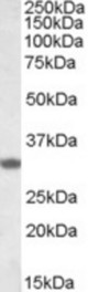 FHL3 antibody (1 ug/ml) staining of Rat Skeletal Muscle lysate (35 ug protein/ml in RIPA buffer). Primary incubation was 1 hour. Detected by chemiluminescence.