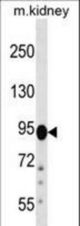 FIG4 Antibody western blot of mouse kidney tissue lysates (35 ug/lane). The FIG4 antibody detected the FIG4 protein (arrow).
