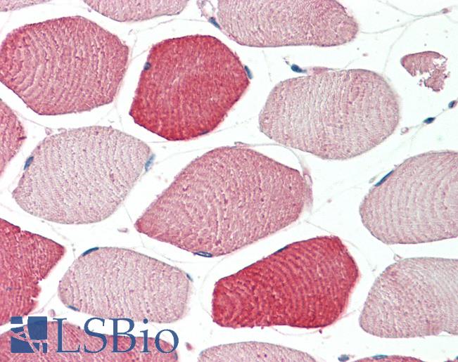 Anti-TOM1L2 antibody IHC staining of human skeletal muscle. Immunohistochemistry of formalin-fixed, paraffin-embedded tissue after heat-induced antigen retrieval. Antibody LS-B10280 concentration 5 ug/ml.