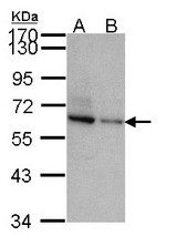 Sample (30 ug of whole cell lysate). A: JurKat, B: NT2D1. 7.5% SDS PAGE. TOM1L2 antibody diluted at 1:1000.