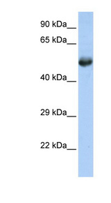 FLI1 antibody LS-C112366 Western blot of Jurkat lysate.