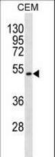 TOM1L2 Antibody western blot of CEM cell line lysates (35 ug/lane). The TOM1L2 antibody detected the TOM1L2 protein (arrow).