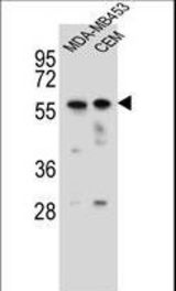 FOXD4 Antibody western blot of MDA-MB453,CEM cell line lysates (35 ug/lane). The FOXD4 antibody detected the FOXD4 protein (arrow).