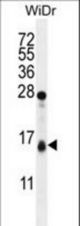 TOMM20L Antibody western blot of WiDr cell line lysates (35 ug/lane). The TOMM20L antibody detected the TOMM20L protein (arrow).