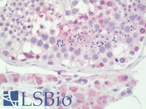 Human Testis: Formalin-Fixed, Paraffin-Embedded (FFPE)