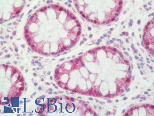 Human Colon: Formalin-Fixed, Paraffin-Embedded (FFPE)
