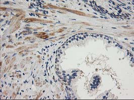 IHC of paraffin-embedded Human prostate tissue using anti-TOMM34 mouse monoclonal antibody.