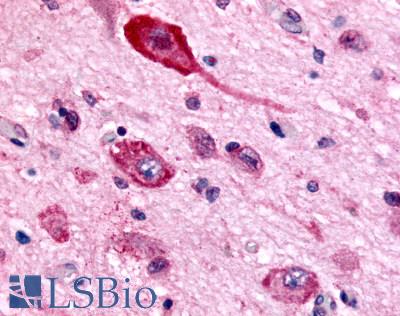 Anti-GABBR1 antibody LS-A5332 IHC of human brain, neurons and glia. Immunohistochemistry of formalin-fixed, paraffin-embedded tissue after heat-induced antigen retrieval.