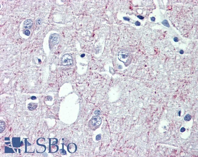 Anti-GABBR1 antibody IHC of human brain, cortex. Immunohistochemistry of formalin-fixed, paraffin-embedded tissue after heat-induced antigen retrieval. Antibody LS-B4142 concentration 3.75 ug/ml.