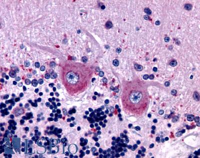 Anti-GABBR1 antibody LS-A5270 IHC of human brain, Purkinje neurons. Immunohistochemistry of formalin-fixed, paraffin-embedded tissue after heat-induced antigen retrieval.
