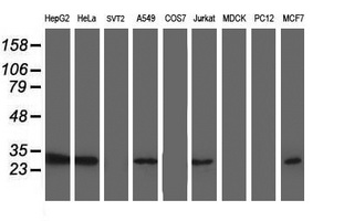 Western blot of extracts (35 ug) from 9 different cell lines by using anti-TOMM34 monoclonal antibody.