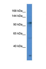 GABBR2 antibody LS-C135925 Western blot of HeLa Cell lysate. Antibody concentration 1 ug/ml.
