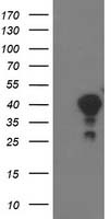 HEK293T cells were transfected with the pCMV6-ENTRY control (Left lane) or pCMV6-ENTRY TOMM34 (Right lane) cDNA for 48 hrs and lysed. Equivalent amounts of cell lysates (5 ug per lane) were separated by SDS-PAGE and immunoblotted with anti-TOMM34.