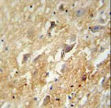 GABBR2 antibody immunohistochemistry of formalin-fixed and paraffin-embedded human brain tissue followed by peroxidase-conjugated secondary antibody and DAB staining.