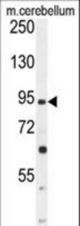 GABBR2 Antibody western blot of mouse cerebellum tissue lysates (35 ug/lane). The GABBR2 antibody detected the GABBR2 protein (arrow).