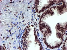 IHC of paraffin-embedded Human prostate tissue using anti-TOMM34 mouse monoclonal antibody.