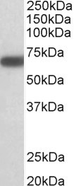 GAD1 antibody (1 ug/ml) staining of Mouse Brain lysate (35 ug protein in RIPA buffer). Primary incubation was 1 hour. Detected by chemiluminescence.