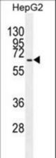 GAD1 Antibody western blot of HepG2 cell line lysates (35 ug/lane). The GAD1 antibody detected the GAD1 protein (arrow).