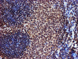 IHC of paraffin-embedded Human tonsil using anti-TOMM34 mouse monoclonal antibody.