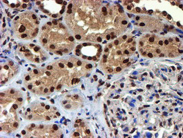IHC of paraffin-embedded Human Kidney tissue using anti-TOMM34 mouse monoclonal antibody.