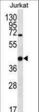 LGALS4 Antibody western blot of Jurkat cell line lysates (35 ug/lane). The LGALS4 antibody detected the LGALS4 protein (arrow).