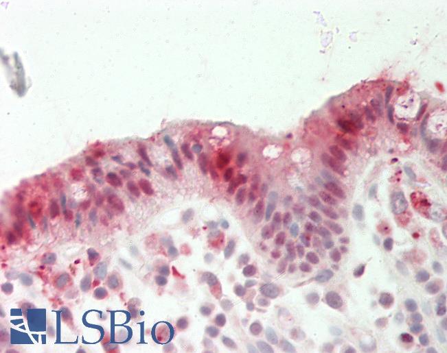 Human Colon: Formalin-Fixed, Paraffin-Embedded (FFPE)