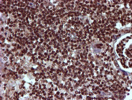 IHC of paraffin-embedded Carcinoma of Human pancreas tissue using anti-TOMM34 mouse monoclonal antibody.