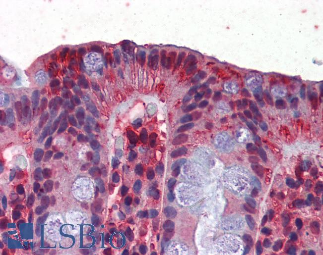 Anti-GAPDH antibody IHC of human colon. Immunohistochemistry of formalin-fixed, paraffin-embedded tissue after heat-induced antigen retrieval. Antibody LS-B2517 concentration 5 ug/ml.