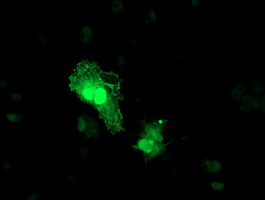 Anti-TOMM34 mouse monoclonal antibody immunofluorescent staining of COS7 cells transiently transfected by pCMV6-ENTRY TOMM34.