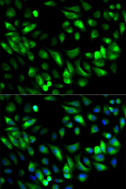 Immunofluorescence analysis of MCF-7 cell using GARS antibody. Blue: DAPI for nuclear staining.
