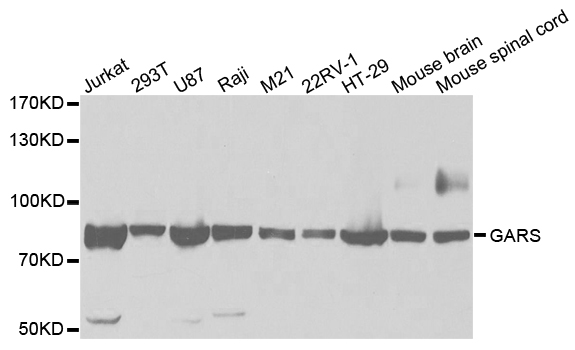 Western blot analysis of extracts of various cell lines, using GARS antibody.