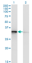 Western blot of TOMM34 expression in transfected 293T cell line by TOMM34 monoclonal antibody (M02), clone 1D2.