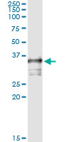 Immunoprecipitation of TOMM34 transfected lysate using anti-TOMM34 monoclonal antibody and Protein A Magnetic Bead.