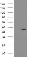 HEK293T cells were transfected with the pCMV6-ENTRY control (Left lane) or pCMV6-ENTRY TOMM34 (Right lane) cDNA for 48 hrs and lysed. Equivalent amounts of cell lysates (5 ug per lane) were separated by SDS-PAGE and immunoblotted with anti-TOMM34.